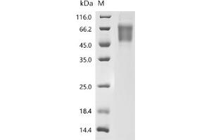 (Tris-Glycine gel) Discontinuous SDS-PAGE (reduced) with 5 % enrichment gel and 15 % separation gel.