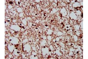 IHC image of ABIN7146885 diluted at 1:300 and staining in paraffin-embedded human brain tissue performed on a Leica BondTM system. (CSNK2A1/CK II alpha anticorps  (AA 1-391))