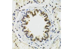 Immunohistochemistry of paraffin-embedded rat lung using RUVBL2 antibody.