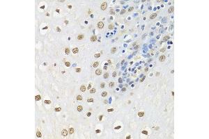 Immunohistochemistry of paraffin-embedded human esophagus using ELAVL1 antibody.