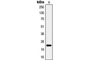 Western blot analysis of KCNMB4 expression in THP1 (A) whole cell lysates.