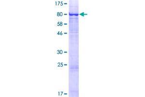 Image no. 1 for Suppression of Tumorigenicity 7 (ST7) (AA 1-547) protein (GST tag) (ABIN1321518)