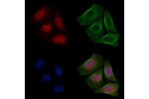 ABIN6255365 and ABIN6267475 staining Hela cells(20 min of 30uM Forskolin treatment) by IF/ICC.