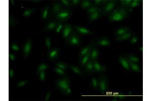 Immunofluorescence of monoclonal antibody to MAK on HeLa cell. (MAK anticorps  (AA 358-457))