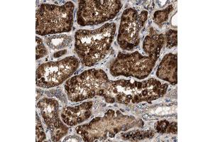 Immunohistochemical staining (Formalin-fixed paraffin-embedded sections) of human kidney using DUSP10 polyclonal antibody  shows strong cytoplasmic positivity with granular pattern in renal tubules. (DUSP10 anticorps  (AA 180-291))