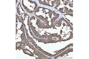 IHC analysis of FADS1 using anti-FADS1 antibody (ABIN7599175).