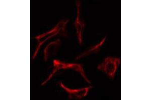 ABIN6269254 staining Hela cells by IF/ICC. (ZAP70 anticorps  (Internal Region))