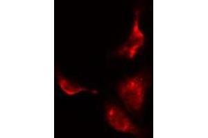 ABIN6275550 staining  HuvEc cells by IF/ICC. (PPP2R3C anticorps  (C-Term))