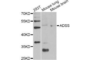 Western blot analysis of extracts of various cell lines, using ADSS Antibody (ABIN6292806) at 1:1000 dilution. (ADSS anticorps)