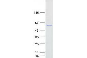 Validation with Western Blot