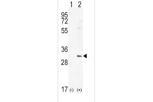 Western blot analysis of HMOX1 (arrow) using rabbit polyclonal HMOX1 Antibody (Center) (ABIN655187 and ABIN2844803).