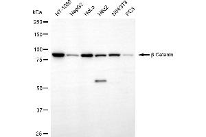 Western blotting analysis using β catenin antibody (ABIN7797936).