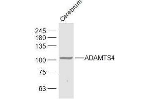 Mouse Cerebrum lysates probed with ADAMTS4 Polyclonal Antibody, Unconjugated  at 1:1000 dilution and 4˚C overnight incubation.