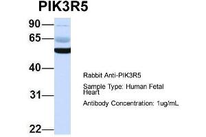 Host: Rabbit  Target Name: PIK3R5  Sample Tissue: Human Fetal Heart  Antibody Dilution: 1.