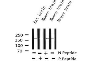 Western blot analysis of Phospho-Ret (Tyr1062) expression in various lysates