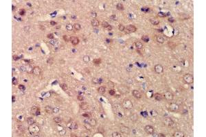 Formalin-fixed and paraffin embedded rat brain labeled with Rabbit Anti-BPTF/FALZ Polyclonal Antibody, Unconjugated (ABIN1386560) at 1:200 followed by conjugation to the secondary antibody and DAB staining (BPTF anticorps  (AA 2801-3046))