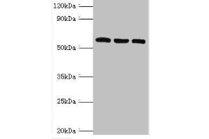 Western blot All lanes: Thioredoxin reductase 2, mitochondrial antibody at 6 μg/mL Lane 1: Mouse liver tissue Lane 2: Mouse gonad tissue Lane 3: Hela whole cell lysate Secondary Goat polyclonal to rabbit IgG at 1/10000 dilution Predicted band size: 57, 54, 47, 31 kDa Observed band size: 57 kDa (TXNRD2 anticorps  (AA 100-310))