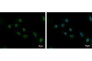 ICC/IF Image UBE2C antibody [N1C3] detects UBE2C protein at cytoplasm and nucleus by immunofluorescent analysis. (UBE2C anticorps)