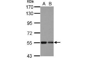 WB Image Sample (30 ug of whole cell lysate) A: U87-MG B: SK-N-SH 7. (KBTBD4 anticorps  (Center))