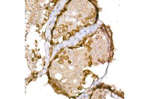Immunohistochemistry of paraffin-embedded human testis using NY-ESO-1 Rabbit pAb (ABIN6129965, ABIN6139172, ABIN6139173 and ABIN6225112) at dilution of 1:150 (40x lens).