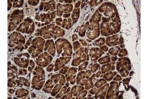 Image no. 6 for anti-SERPINE1 mRNA Binding Protein 1 (SERBP1) (AA 1-262) antibody (ABIN1490675)