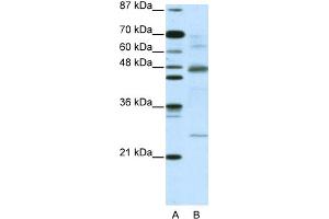 WB Suggested Anti-NFKBIB Antibody Titration:  5. (NFKBIB anticorps  (C-Term))