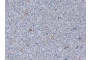 Detection of FCN1 in Rat Spinal cord Tissue using Polyclonal Antibody to Ficolin 1 (FCN1)