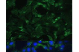Immunofluorescence analysis of C6 cells using ENO1 Polyclonal Antibody at dilution of 1:100.