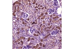 IHC testing of FFPE mouse kidney tissue with PDGFRB antibody at 2 ug/ml. (PDGFRB anticorps  (AA 911-992))