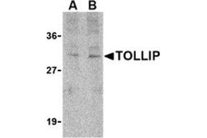 Western blot analysis of TOLLIP in rat brain cell lysate with this product at (A) 1 and (B) 2 μg/ml. (TOLLIP anticorps  (C-Term))