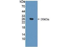Detection of Recombinant TAGLN2, Human using Polyclonal Antibody to Transgelin 2 (TAGLN2) (TAGLN2 anticorps  (AA 2-199))
