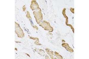 Immunohistochemistry of paraffin-embedded human esophagus using CKMT2 antibody (ABIN5975698) at dilution of 1/100 (40x lens). (CKMT2 anticorps)