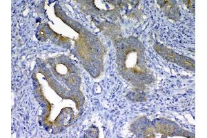 IHC analysis of MMP10 using anti-MMP10 antibody (A03759).