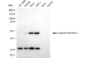 Western blotting analysis using epoxide hydrolase 1 antibody (ABIN7798484).