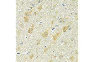 Immunohistochemistry of paraffin-embedded rat brain using SLC25A1 antibody.