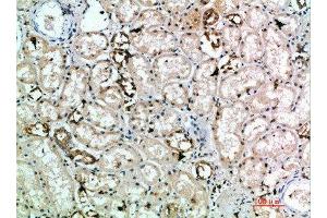 Immunohistochemical analysis of paraffin-embedded human-kidney, antibody was diluted at 1:200