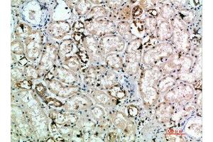 Immunohistochemical analysis of paraffin-embedded human-kidney, antibody was diluted at 1:200 (KLRK1 anticorps  (AA 167-216))