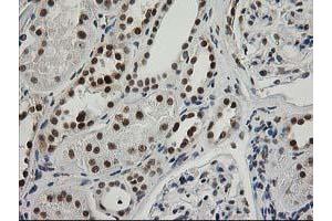 Image no. 5 for anti-Excision Repair Cross-Complementing Rodent Repair Deficiency, Complementation Group 4 (ERCC4) antibody (ABIN1498070)