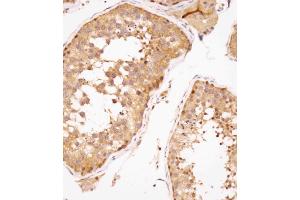 Immunohistochemical analysis of (ABIN391446 and ABIN2841429) on paraffin-embedded human testis tissue was performed on the Leica®BOND RXm. (SPAG9 anticorps  (N-Term))
