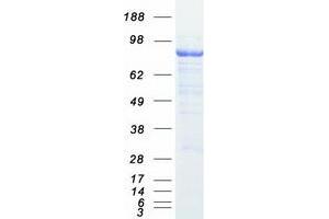 Validation with Western Blot
