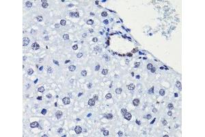 Immunohistochemistry of paraffin-embedded Mouse liver using Acetyl-Histone H2A-K5 Polyclonal Antibody at dilution of 1:100 (40x lens). (Histone H2A anticorps  (acLys5))