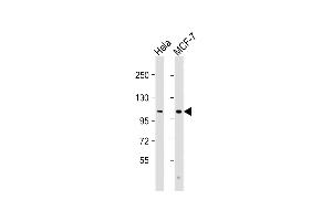 All lanes : Anti-VLDLR Antibody (C-Term) at 1:2000 dilution Lane 1: Hela whole cell lysate Lane 2: MCF-7 whole cell lysate Lysates/proteins at 20 μg per lane. (VLDLR anticorps  (AA 608-642))