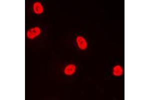 anti-Transcription Factor Dp-1 (TFDP1) (C-Term) antibody