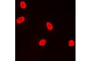 Immunofluorescent analysis of TFDP1 staining in A431 cells. (DP1 anticorps  (C-Term))