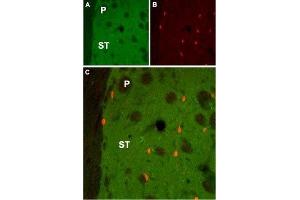 Expression of Muscarinic acetylcholine receptor M1 in rat striatumImmunohistochemical staining of rat striatum (ST) using Anti-CHRM1 Antibody (ABIN7043060, ABIN7044580 and ABIN7044581). (Muscarinic Acetylcholine Receptor M1 (CHRM1) Peptide)