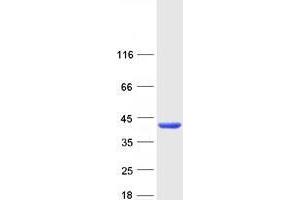 Validation with Western Blot