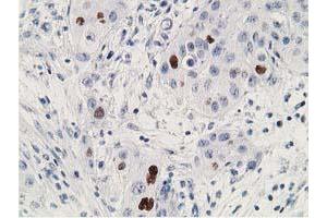 Image no. 2 for anti-Tumor Protein P53 (TP53) antibody (ABIN1499968) (p53 anticorps)