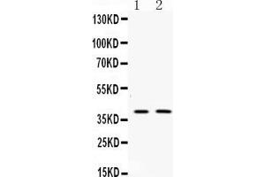 Western blot analysis of Doublecortin expression in rat brain extract ( Lane 1) and mouse brain extract ( Lane 2).