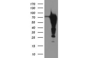 Western Blotting (WB) image for anti-Epsin 2 (EPN2) antibody (ABIN1498053) (Epsin 2 anticorps)