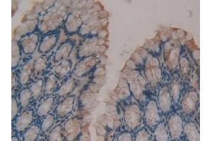 Detection of F13A1 in Mouse Intestine Tissue using Polyclonal Antibody to Coagulation Factor XIII A1 Polypeptide (F13A1)